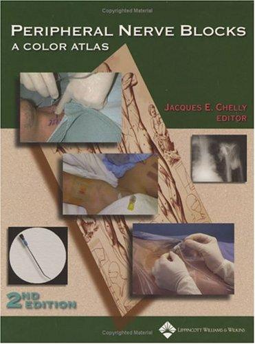 Cover for Peripheral Nerve Blocks