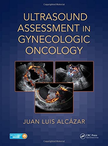 Cover for Ultrasound Assessment in Gynecologic Oncology
