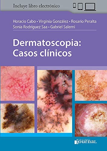 Cover for Dermatoscopia