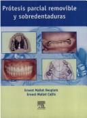 Cover for Protesis Parcial Removible y Sobredentadura