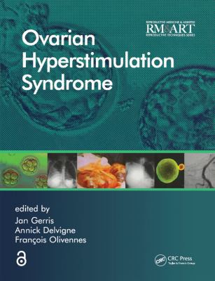 Cover for Ovarian Hyperstimulation Syndrome
