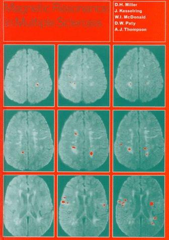 Cover for Magnetic resonance in multiple sclerosis