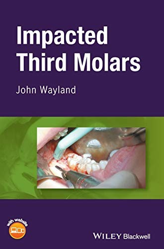 Cover for Impacted Third Molars