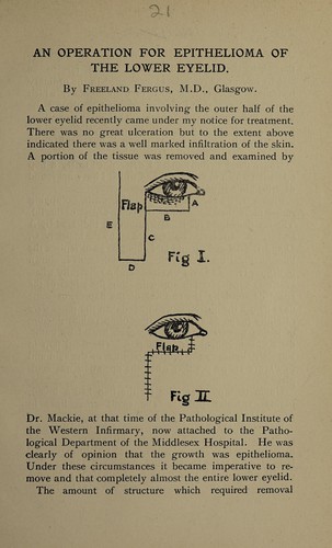 Cover for An operation for epithelioma of the lower eyelid