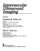 Cover for Intravascular ultrasound imaging
