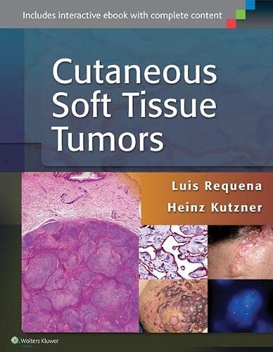 Cover for Cutaneous Soft Tissue Tumors