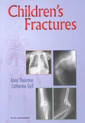 Cover for Children's Fractures