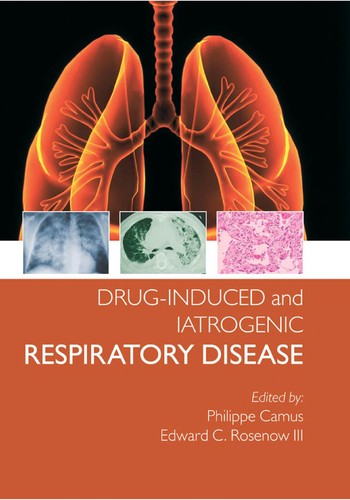 Cover for Drug-Induced and Iatrogenic Lung Disease