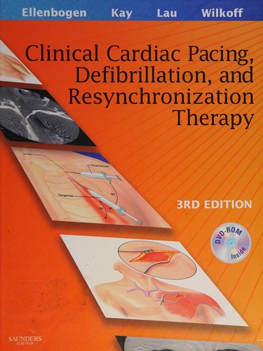 Cover for Clinical cardiac pacing and defibrillation therapy