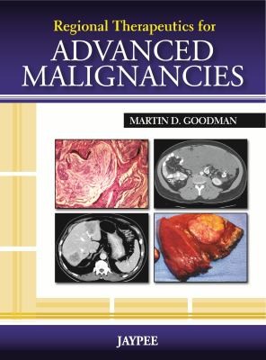 Cover for Regional Therapeutics For Advanced Malignancies