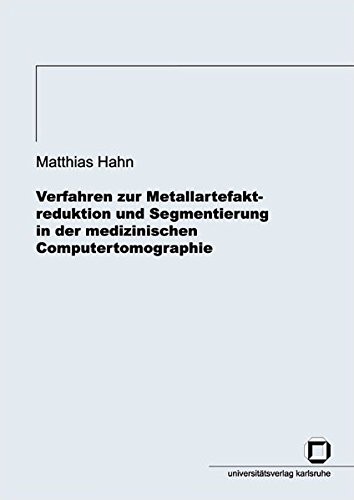 Cover for Verfahren zur Metallartefaktreduktion und Segmentierung in der medizinischen Computertomographie