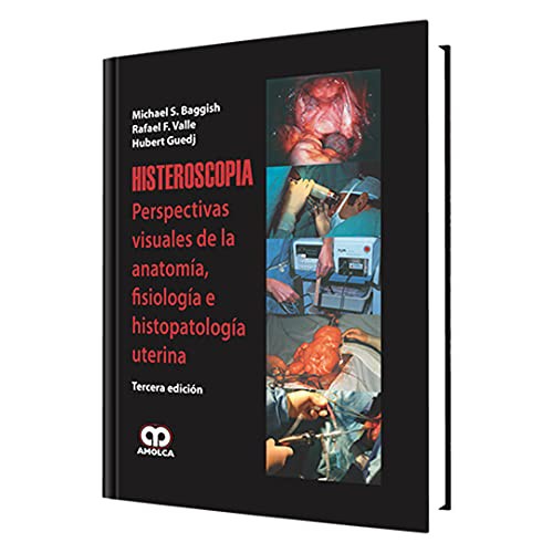 Cover for Histeroscopía, Tercera Edición