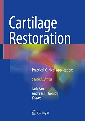 Cover for Cartilage Restoration