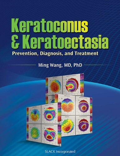 Cover for Keratoconus & keratoectasia