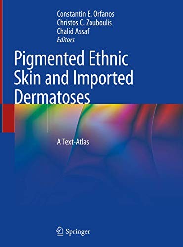 Cover for Pigmented Ethnic Skin and Imported Dermatoses