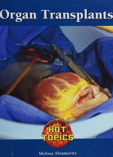 Cover for Organ transplants