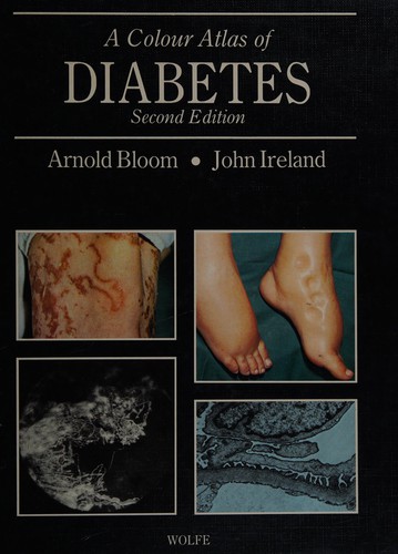 Cover for Color Atlas Diabetes
