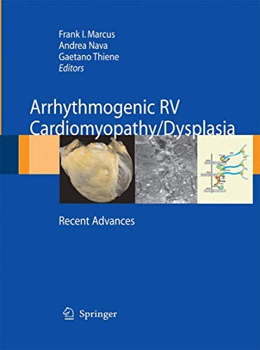 Cover for Arrhythmogenic RV Cardiomyopathy/Dysplasia
