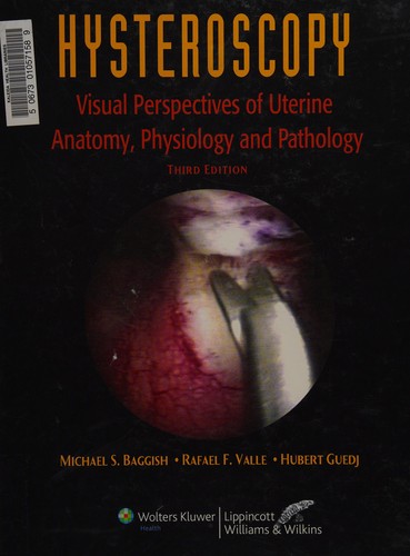 Cover for Hysteroscopy