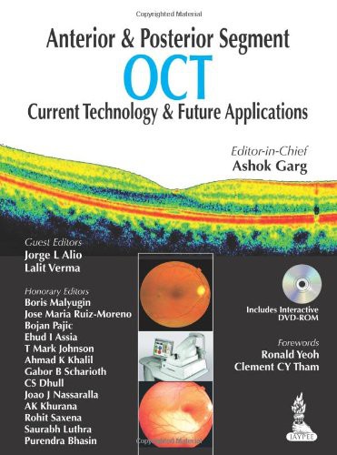 Cover for Anterior & Posterior Segment OCT