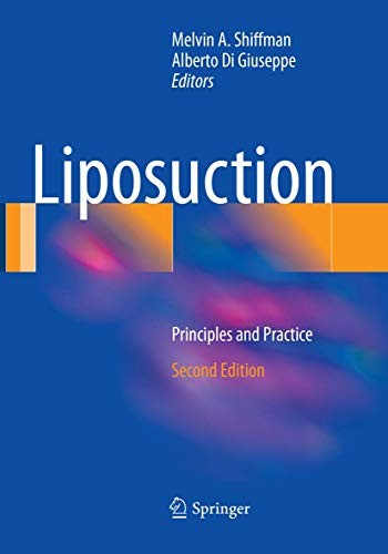 Cover for Liposuction