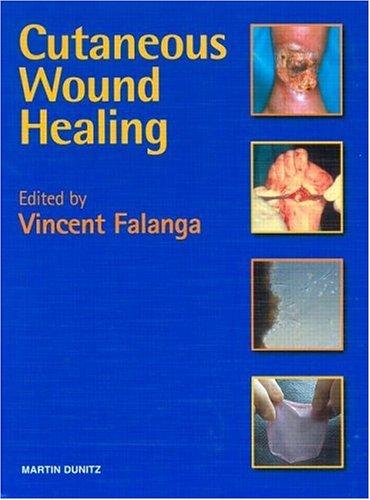Cover for Cutaneous Wound Healing