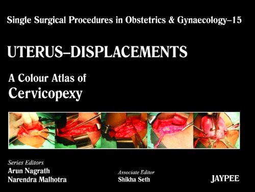 Cover for Uterus-Displacements