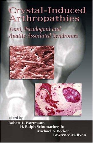 Cover for Crystal-Induced Arthropathies