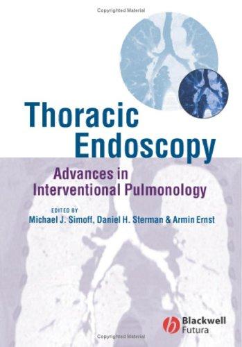 Cover for Thoracic Endoscopy