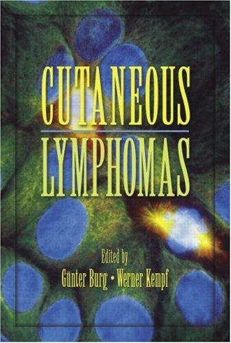 Cover for Cutaneous Lymphomas (Basic and Clinical Dermatology)