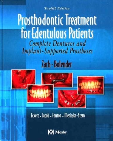 Cover for Prosthodontic treatment for edentulous patients