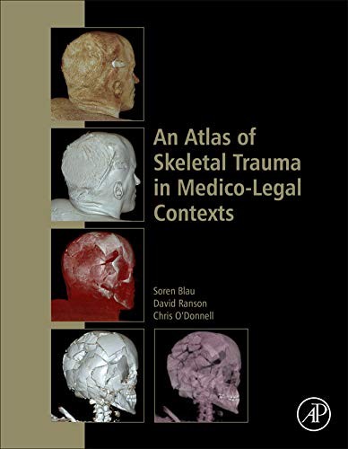 Cover for Atlas of Skeletal Trauma in Medico-Legal Contexts