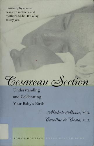 Cover for Cesarean section