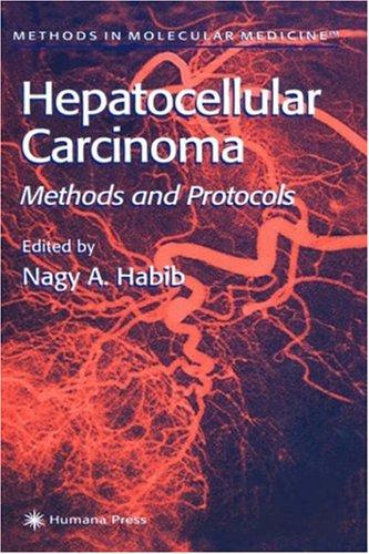 Cover for Hepatocellular Carcinoma