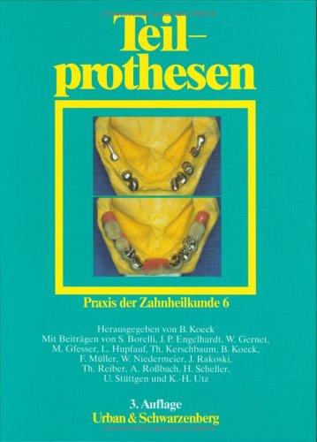Cover for Praxis der Zahnheilkunde, 14 Bde. in 16 Tl.-Bdn., Bd.6, Teilprothesen