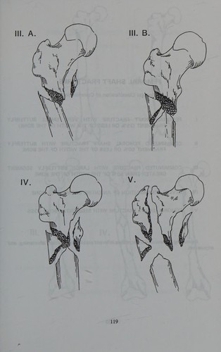 Cover for Handbook of common orthopaedic fractures and drugs