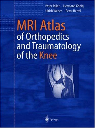 Cover for MRI Atlas of Orthopedics and Trauma Surgery of the Knee