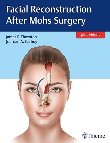 Cover for Facial Reconstruction after Mohs Surgery