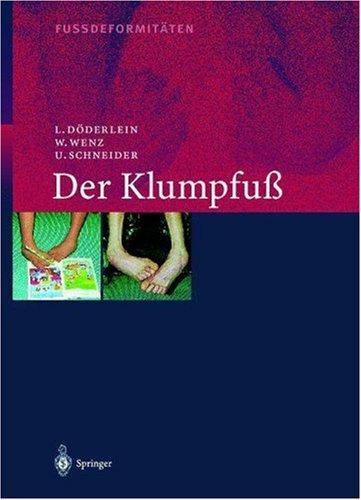 Cover for Fussdeformitäten