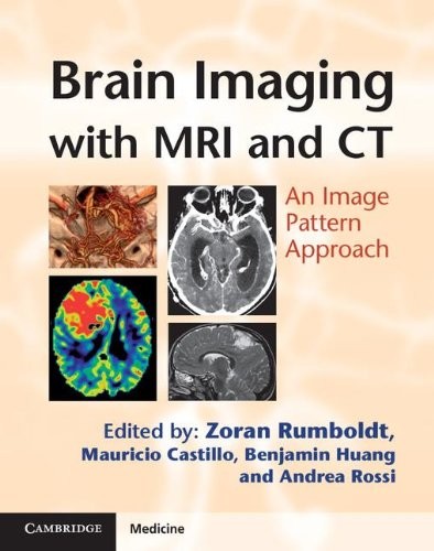 Cover for Brain imaging with MRI and CT