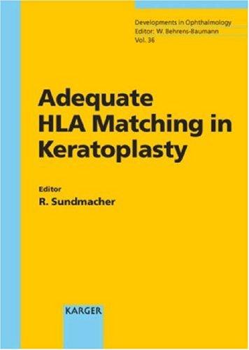Cover for Adequate Hla Matching in Keratoplasty (Developments in Ophthalmology)