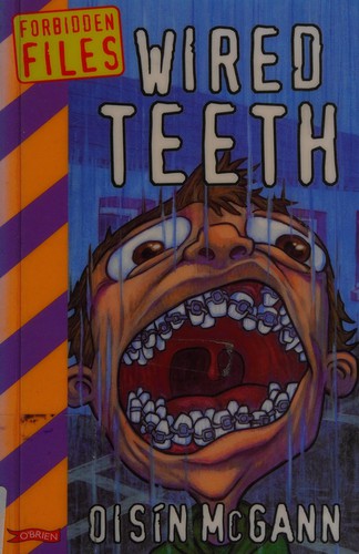 Cover for Wired teeth