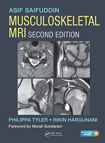 Cover for Musculoskeletal MRI, Second Edition