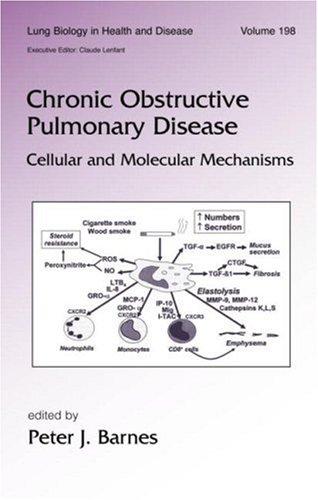 Cover for Chronic Obstructive Pulmonary Disease