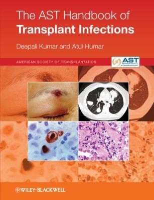 Cover for The Ast Handbook Of Transplant Infections