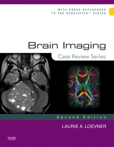 Cover for Brain imaging