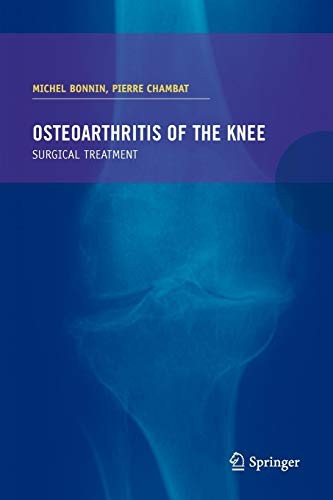 Cover for Osteoarthritis of the knee