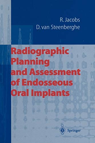 Cover for Radiographic Planning and Assessment of Endosseous Oral Implants