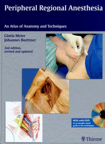 Cover for Peripheral Regional Anesthesia