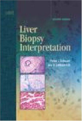 Cover for Liver Biopsy Interpretation